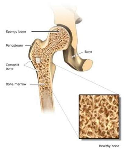 <p>Cancellous (spongy) bone </p>