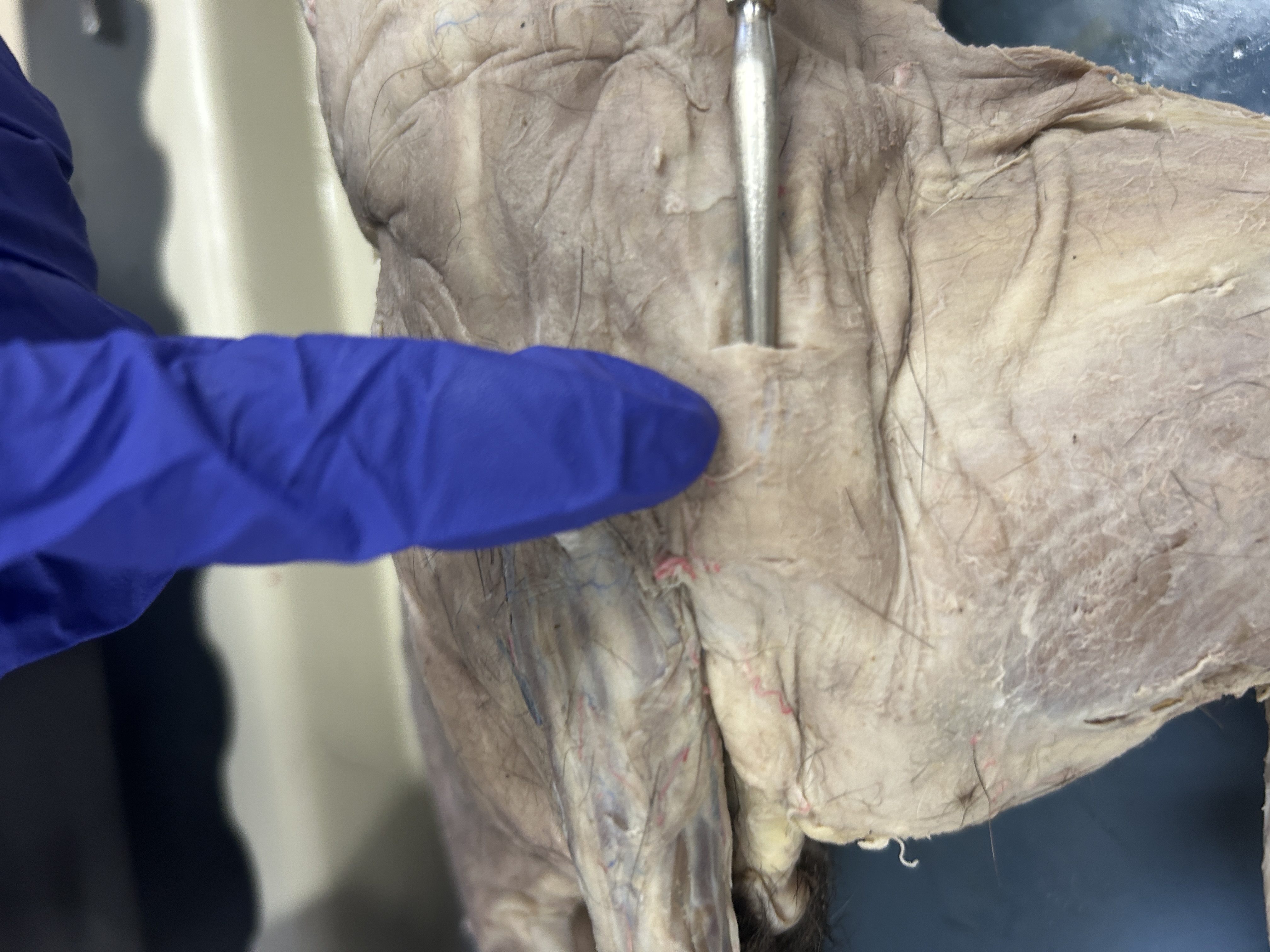 <p>Gluteus maximus(next to top of tail)</p>