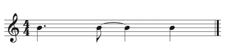 <p>What rhythm pattern is this? </p>