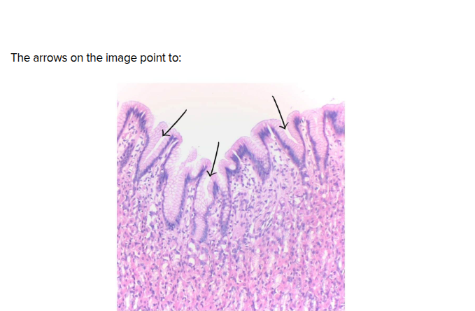 <p>The arrows on the image show?</p>