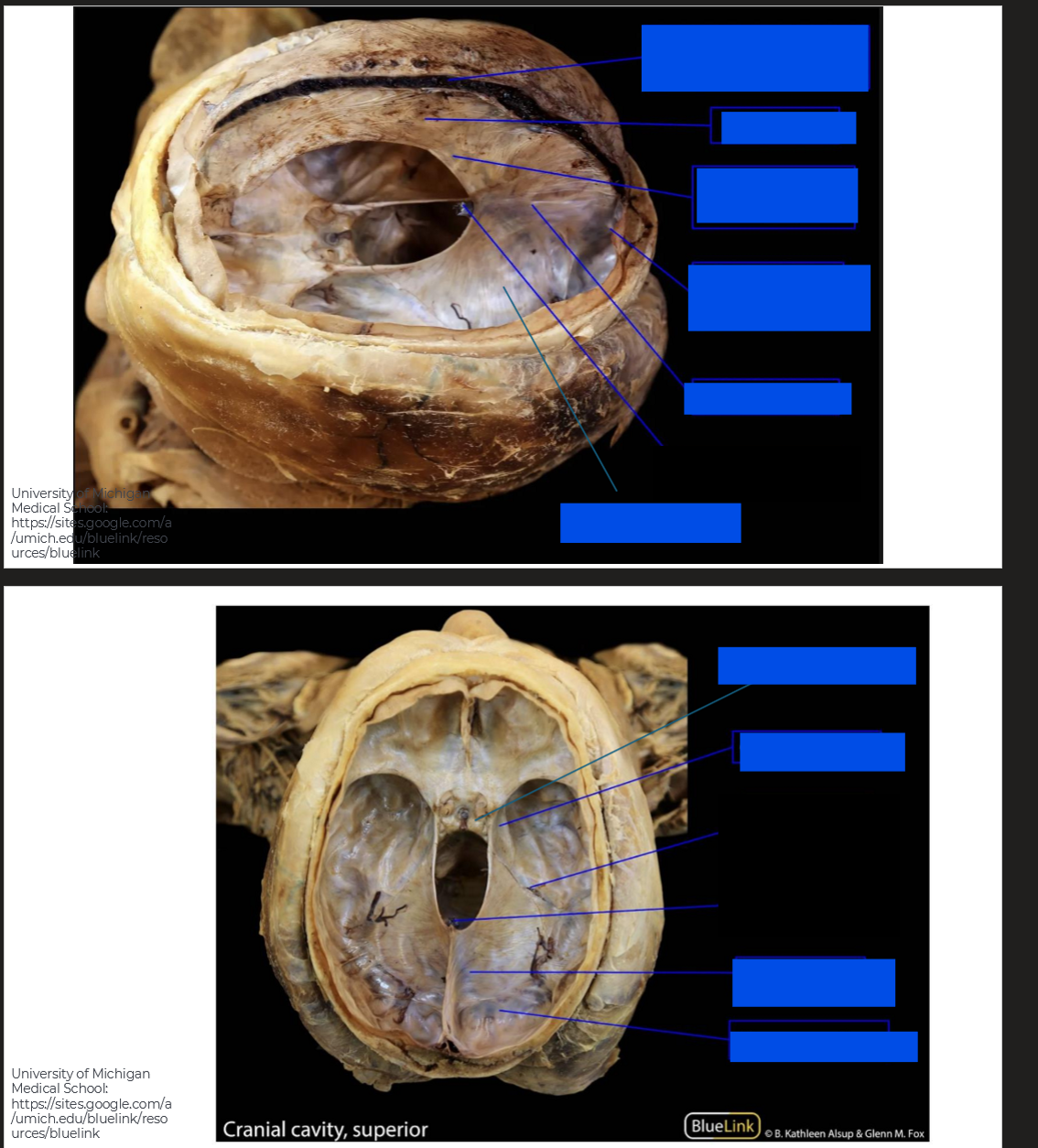 <p>Label these diagrams of the cranial cavity</p>