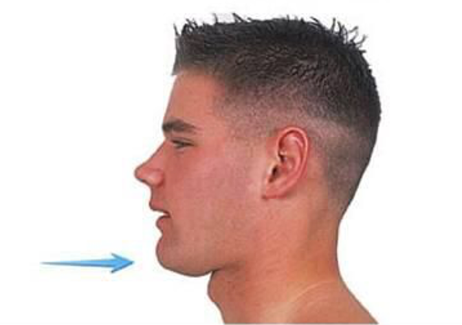 <p>_____ is the posterior movement of a body part without changing the angle.</p>