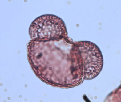 <p>Identify the pollen grains to the <strong>Family</strong> and <strong>Genus</strong></p>