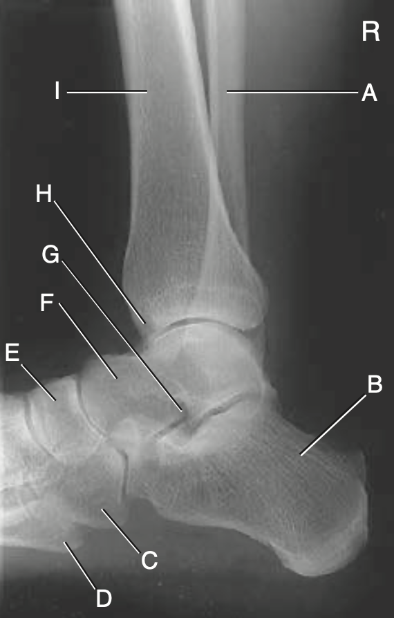 <p>H</p>