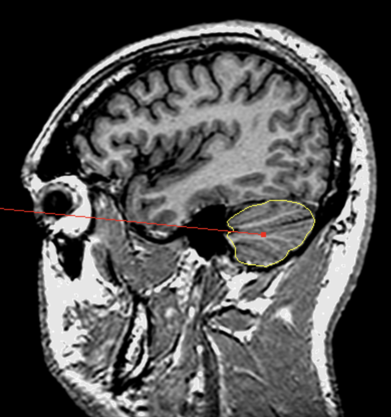 <p>What is the area highlighted called?</p>