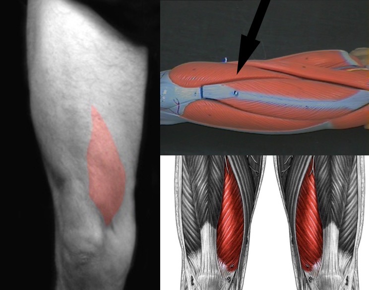 <p>What muscle is this?</p>