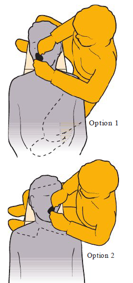 <p><strong>Torso position</strong></p><ul><li><p>Sit facing the side of patient’s head</p></li><li><p>Midline of torso — patient’s mouth</p></li></ul><p><strong>Leg position</strong></p><ol><li><p>Straddling patient chair (<span style="color: rgb(255, 0, 0);"><strong>best</strong></span>)</p></li><li><p>Underneath headrest of patient’s chair</p></li></ol><p><strong>Arm positions</strong></p><ul><li><p>Lower left arm align with patient’s shoulder</p></li><li><p>Right hand and wrist over patient’s left eye</p></li></ul><p><strong>Line of vision</strong></p><ul><li><p>Straight ahead into patient’s mouth </p></li></ul><p></p>