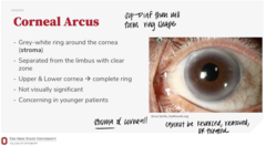 <p>What is the appearance of corneal arcus?</p>