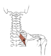 <p>What muscle is this? </p>