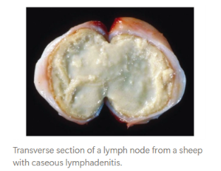<p>Caseous necrosis is <span><strong>localised tissue death in which both cellular detail and tissue architecture are completely destroyed.</strong></span></p><ul><li><p>The dead tissue becomes pale granular material resembling <span><strong>crumbly cheese</strong></span>.</p></li></ul><p></p>