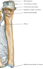 <p>The ulnar styloid process is the distal ending of the</p>