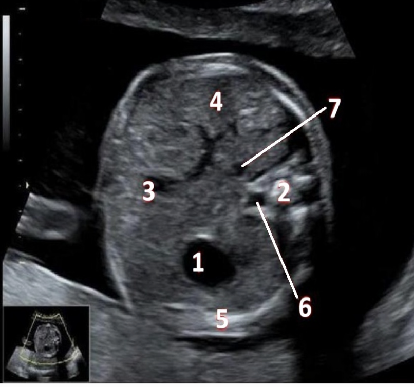 <p>What is number 4?</p>
