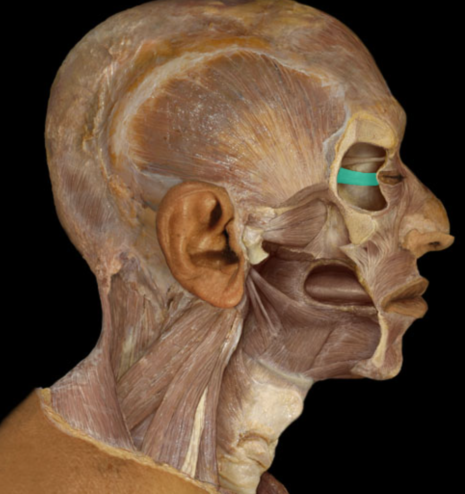 <p>Action:</p><ul><li><p>Adduction of eyeball (e.g., looking inward)</p></li></ul><p>Origin:</p><ul><li><p>Common tendinous ring (at posterior of orbit)</p></li></ul><p>Insertion:</p><ul><li><p>Sclera (medial surface of eyeball)</p></li></ul><p>Innervation:</p><ul><li><p>Oculomotor nerve (CN III)</p></li></ul><p>Comment:</p><ul><li><p>Common tendinous ring is a fibrous band inside the orbit that surrounds optic canal and part of superior orbital fissure</p></li></ul><p></p>