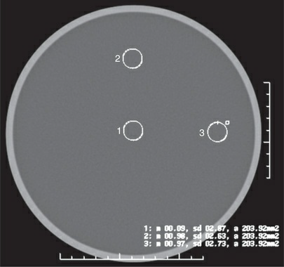 <p>Which of the following components of CT image quality are</p><p>being evaluated in the figure?</p><p>1. low-contrast detectability</p><p>2. noise</p><p>3. uniformity</p><p>a. 2 only</p><p>b. 1 and 2 only</p><p>c. 1 and 3 only</p><p>d. 2 and 3 only</p>