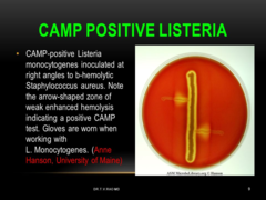 <p>CAMP positive </p><p>-Shovel (not arrowhead)</p>