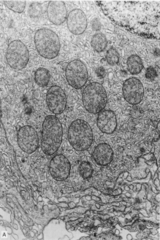 <p>abundance of SER >> stains with eosin producing a pink cytoplasm</p><p>Lipid vacuoles do not stain >> appear as small clear openings in cytoplasm</p><p>mitochondria with tubular cristae</p>