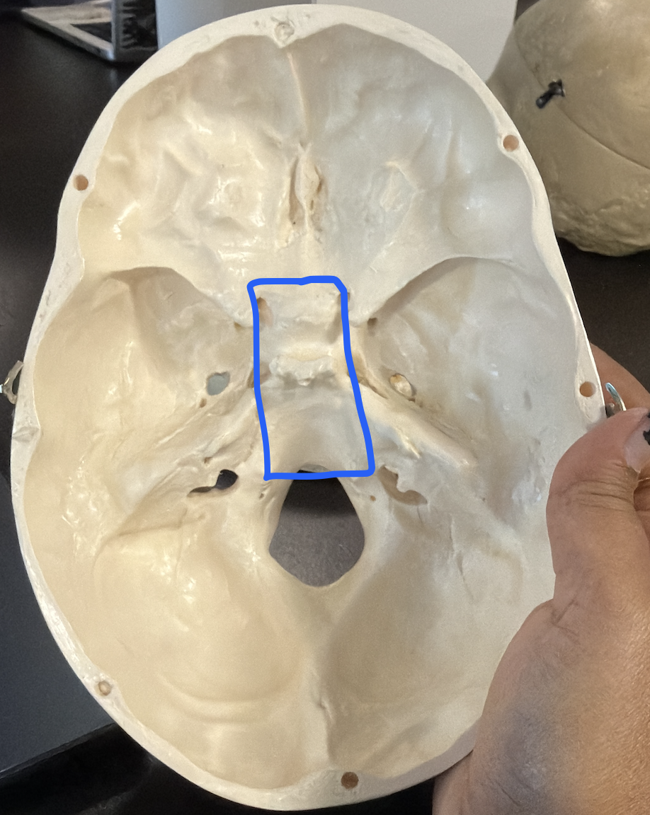 <p>central part of the sphenoid; houses the sphenoidal sinus</p>