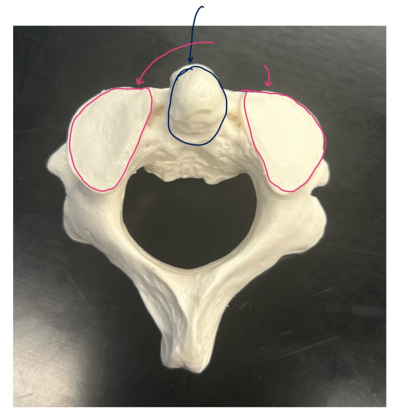 <p>What bone is this?</p>