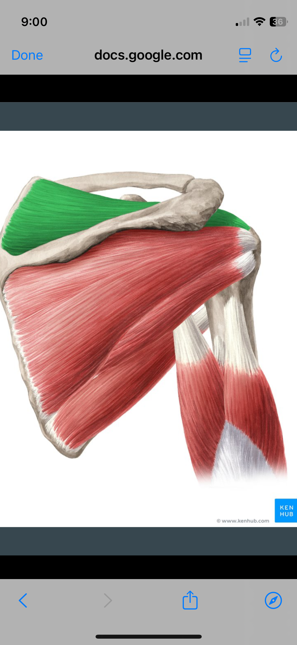 <p>Supraspinous</p>