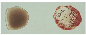 <p>What blood type is this?</p>