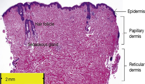 <p>Reticular layer contents </p>