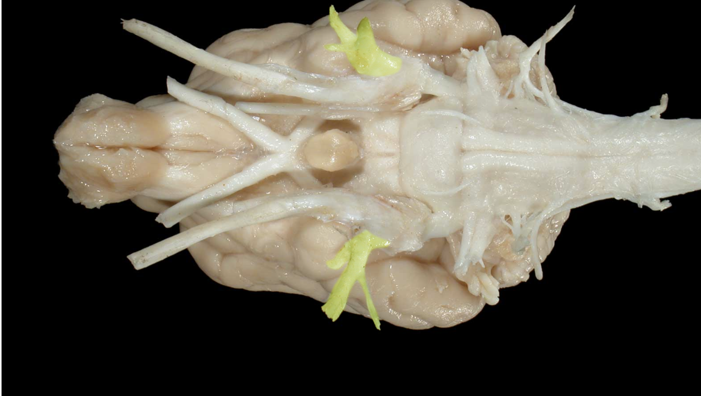 <p>what nerve is this and branch </p>