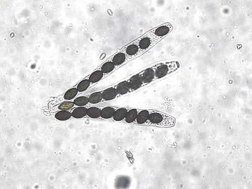 <p>a spore produced within a saclike structure (the ascus)</p>