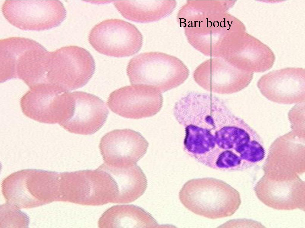 <p><strong>Barr body</strong></p>