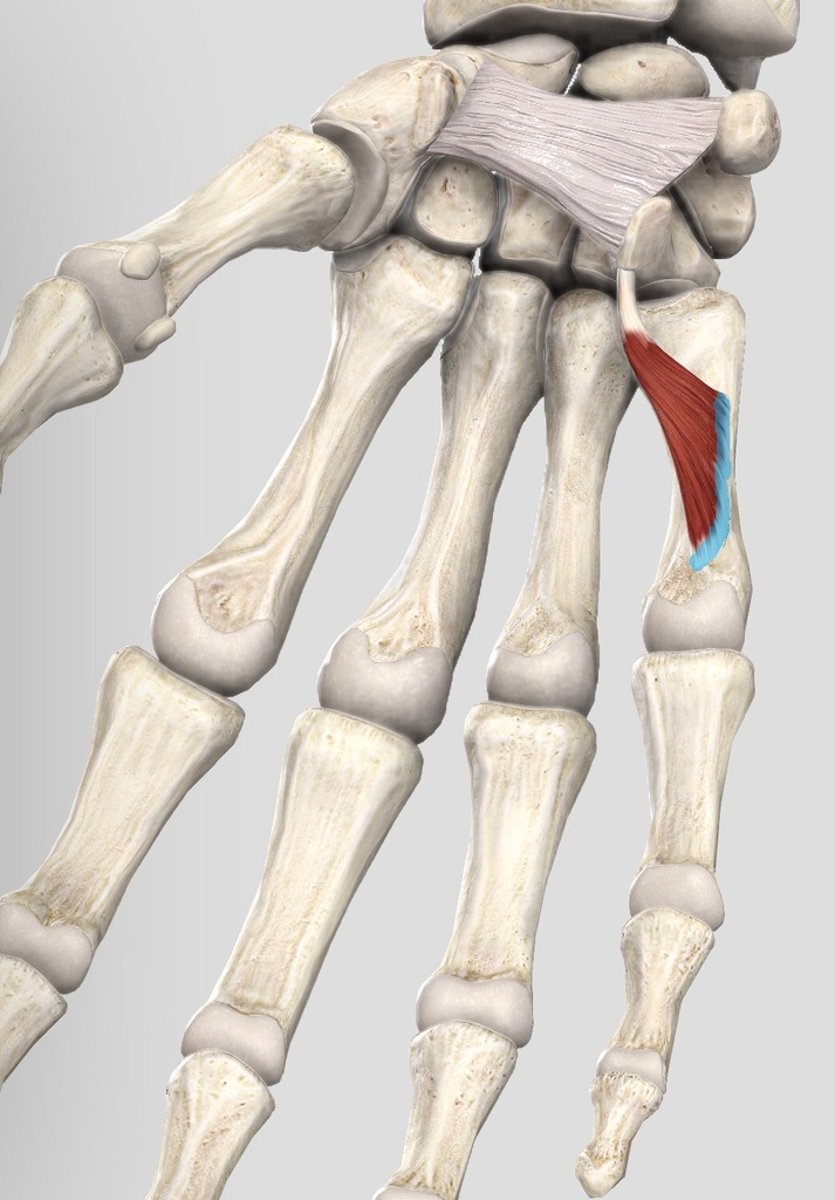 <p>Ulnar side of 5th metacarpal</p>