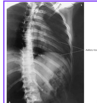 <p>anatomy, projection, position</p>