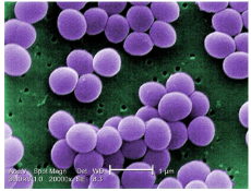 <p>Staphylococcus Aureus</p>