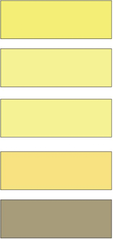 <p>What is this urine showing?</p>