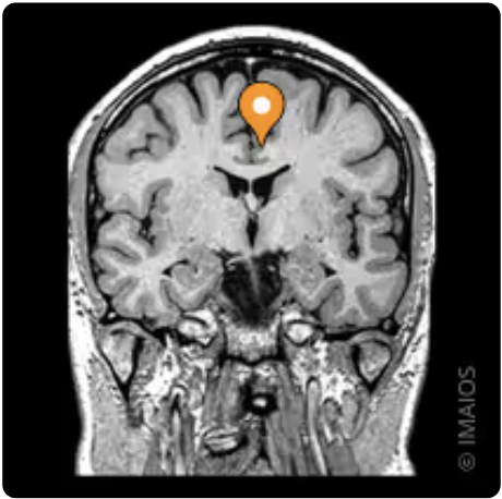 <p>Name the gyrus, modality, and the plane</p>