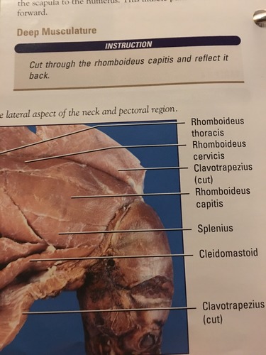<p>Rhomboidius (major & minor)</p>
