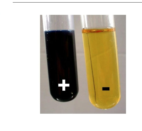 <p>What is this test?</p>