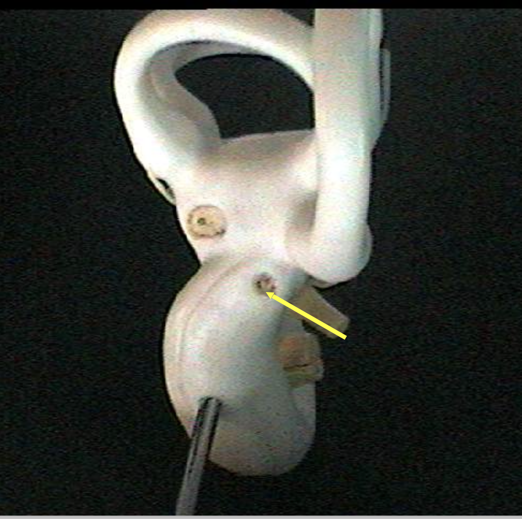 <p>Identify the inner ear parts.</p>