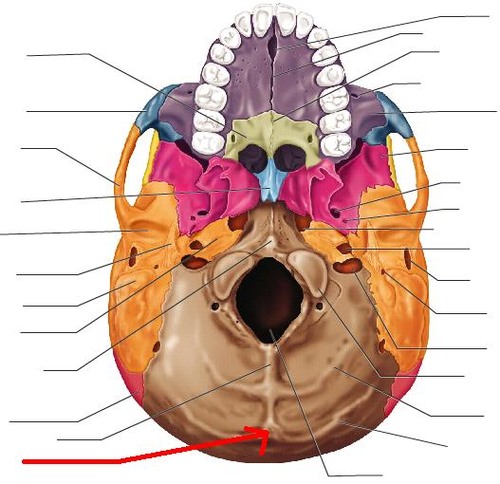 term image