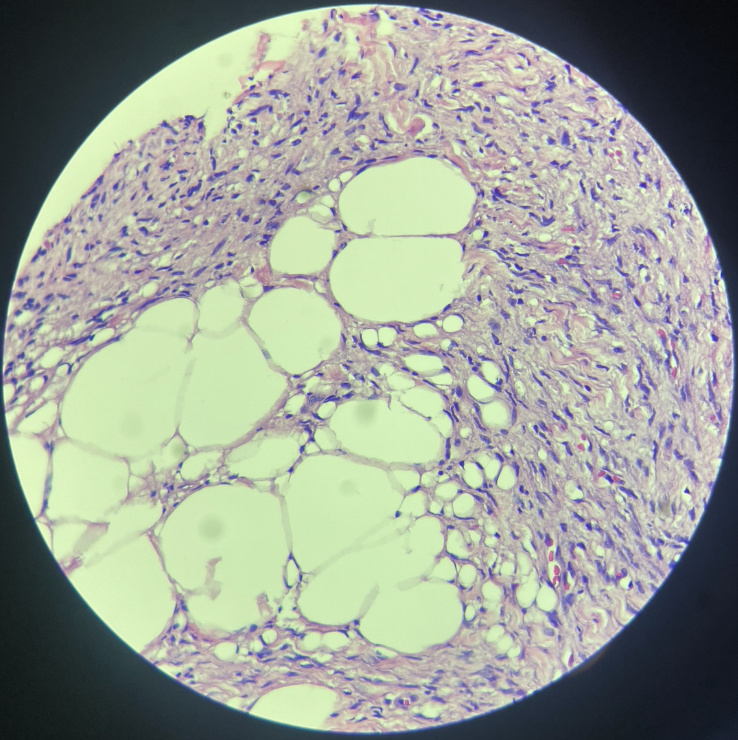 <p>Identify</p><ul><li><p>Lesions:</p></li><li><p>Morphological Diagnosis:</p></li></ul><p></p>