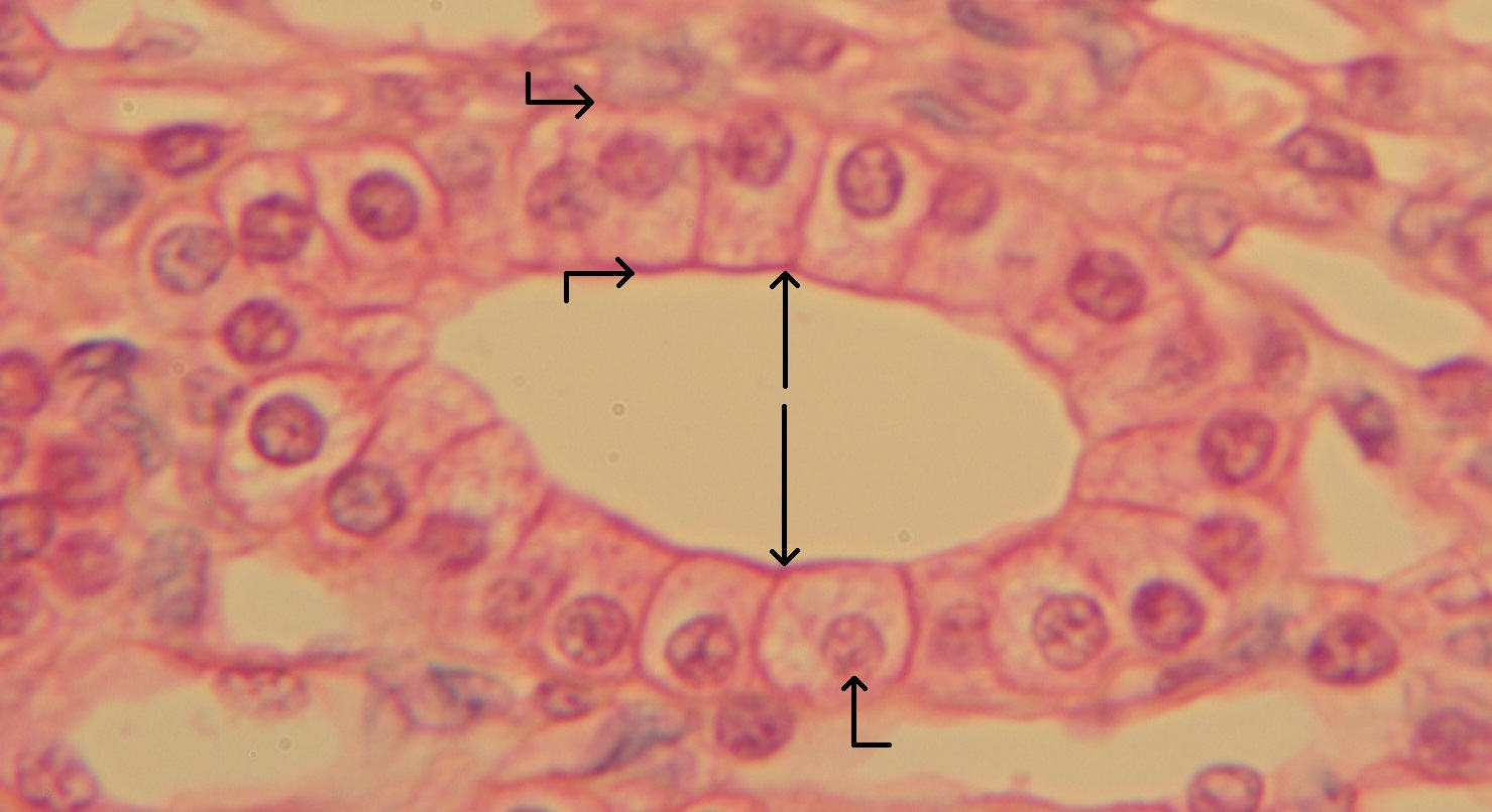 <p>what <strong>shape</strong> of epithelial tissue does this image display?</p>