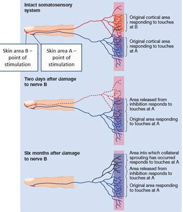 <p><strong>strengthening </strong>of <strong>existing connections</strong> through the release of <strong>inhibition </strong>of <strong>adjacent nerves</strong></p><p><strong>collateral sprouting</strong></p><ul><li><p>vacant synapses become occupied and establish new functional pathways and connections</p></li></ul><p><strong>synaptic plasticity</strong></p><ul><li><p>strengthening/weakening existing synapses based on activity</p><ul><li><p><strong>long-term potentiation/depression</strong></p></li></ul></li><li><p>differs to pruning, which is eliminating synapses to increase brain efficiency</p></li></ul><p></p>