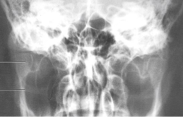 <p><span style="background-color: transparent;">TMJ Townes: open or closed?</span></p>