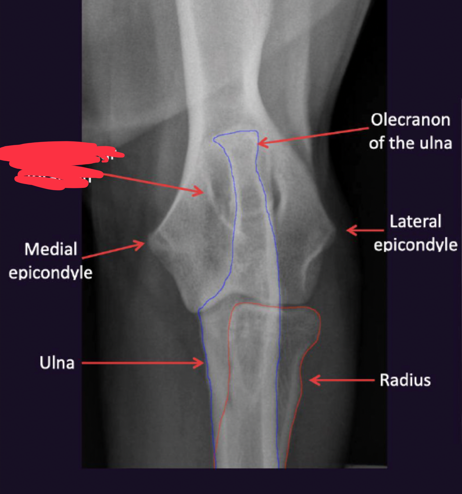 term image