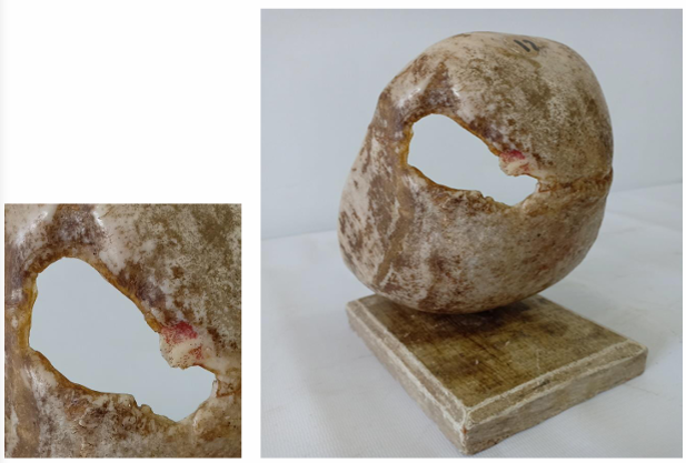 <p>Questions</p><ol><li><p>What is the specimen being examined?</p></li><li><p>What are the type, specific descriptive features, and dimensions of the gap on the skull?</p></li><li><p>How is the time of death estimated based on the healing signs of the bone and tissue?</p></li><li><p>What are the possible causes of death?</p></li><li><p>What is the final diagnosis for this specimen?</p></li></ol><p></p>