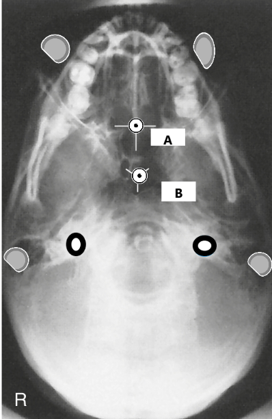 <p>The letter <strong><em>B</em></strong><em> </em>represents what anatomy?</p>