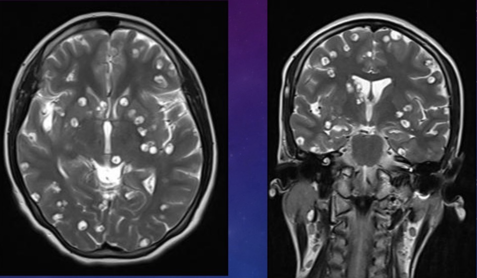 <p>20 year-old female presents with convulsions</p>