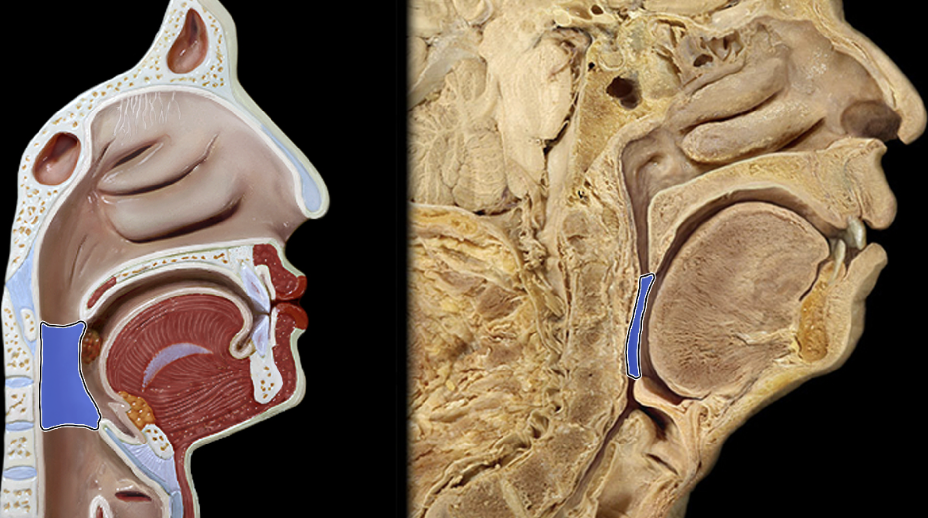 <p>Oropharynx</p>