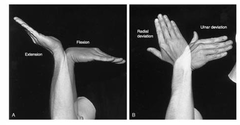 <p>2 degrees of freedom:</p><p>Flex/Ext</p><p>Radial/ulnar deviation</p>