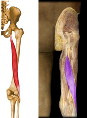 <p>ischial tuberosity</p>