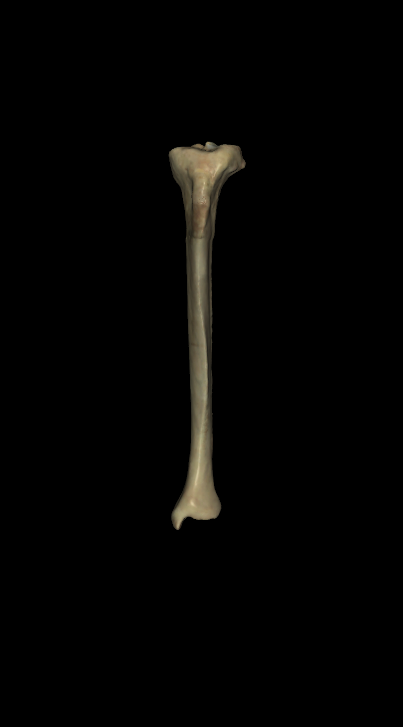 <p>left or right tibia? (anterior view)</p>