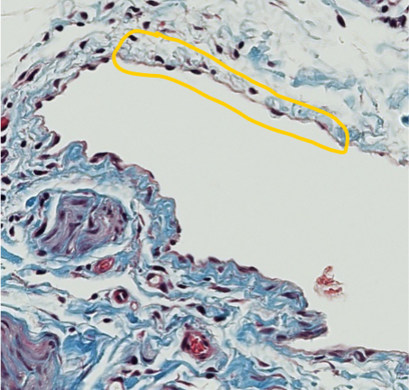 <p><span style="font-family: "Calibri Light";">Which type of epithelium is encircled in yellow?</span></p>